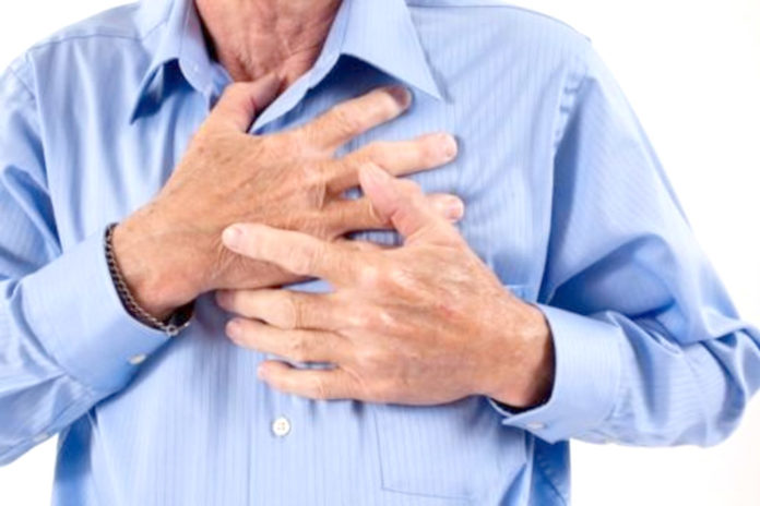 infarto-fulminante “infarto fulminante”