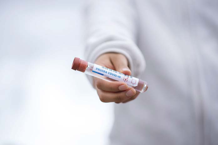 test-tube-5065426 covid-19 en Dos Hermanas