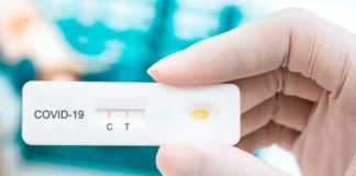 Tests de antígenos en las farmacias nazarenas sin receta médica farmacias nazarenas