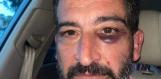 Denuncia una paliza de la Policía Local de Sevilla Policía Local de Sevilla
